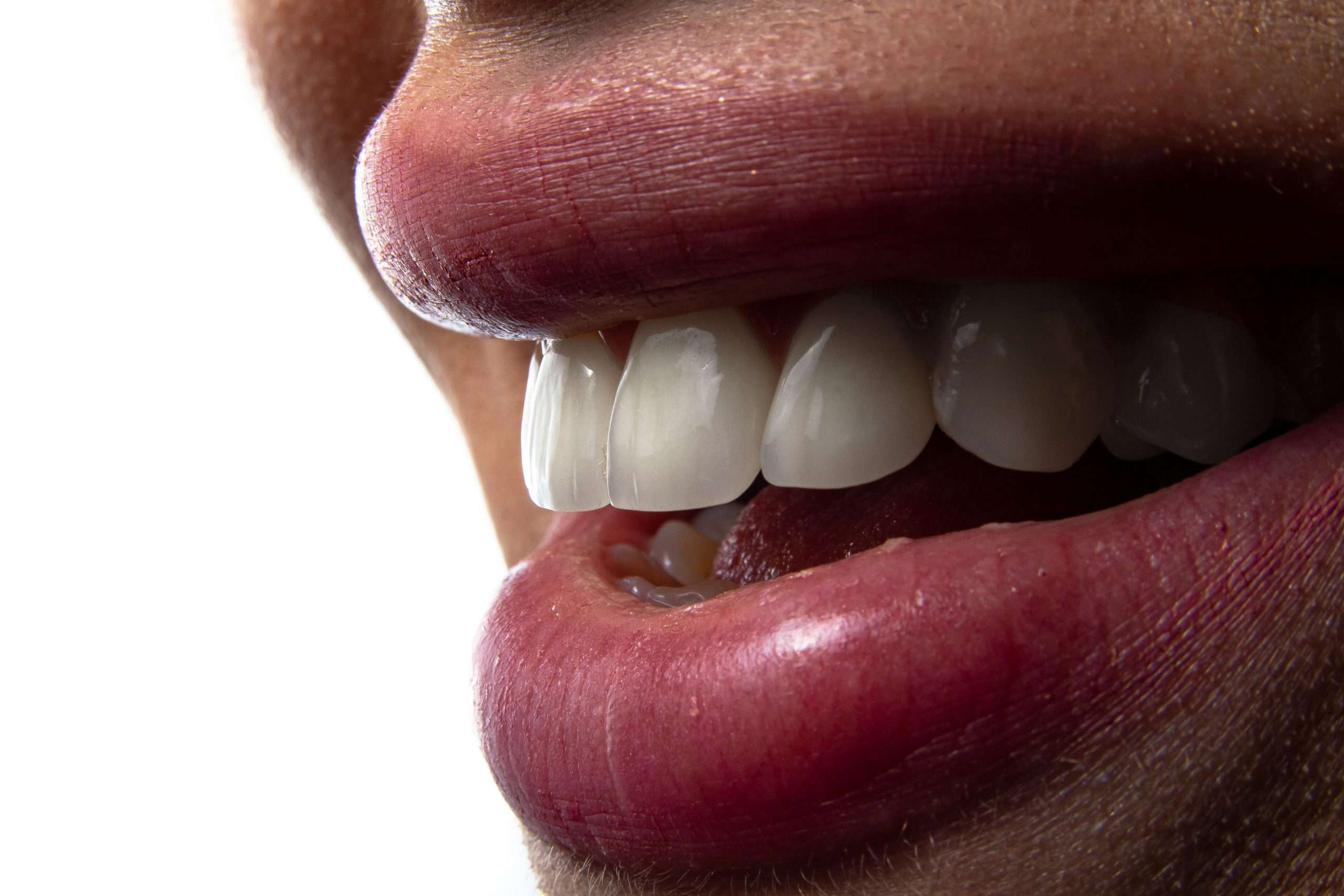 Dental Implant Structure